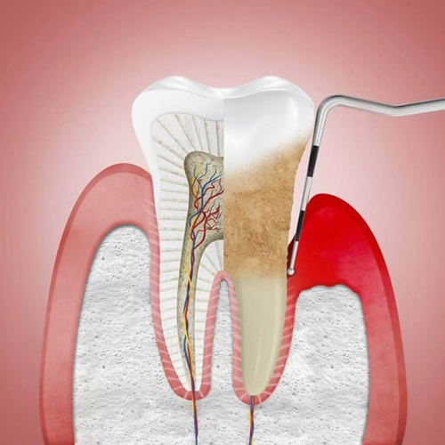 periodoncia.jpg