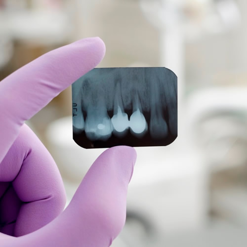 radiografias.jpg